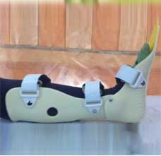 JM463塑料动态踝足矫形器